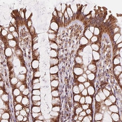 Invitrogen CLPB Polyclonal Antibody 100 &mu;L; Unconjugated:Antibodies,