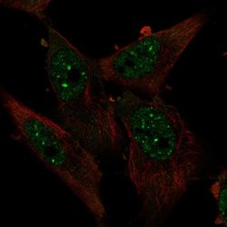 Invitrogen ZBTB4 Polyclonal Antibody 100 &mu;L; Unconjugated:Antibodies,