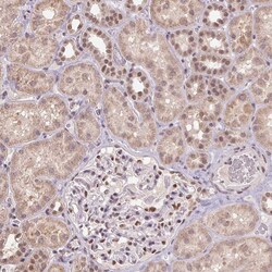 Invitrogen ZBTB4 Polyclonal Antibody 100 &mu;L; Unconjugated:Antibodies,