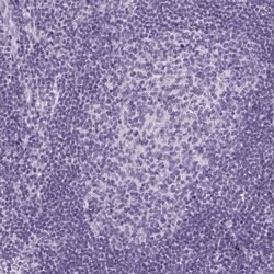 Invitrogen LRP2 Polyclonal Antibody 100 &mu;L; Unconjugated:Antibodies,