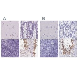 Invitrogen SHCBP1L Polyclonal Antibody 100 &mu;L; Unconjugated:Antibodies,