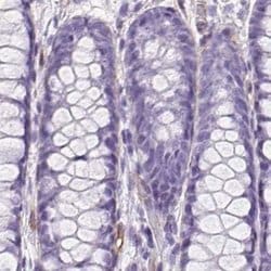 Invitrogen SHCBP1L Polyclonal Antibody 100 &mu;L; Unconjugated:Antibodies,