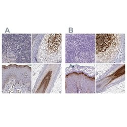 Invitrogen GSDMA Polyclonal Antibody 100 &mu;L; Unconjugated:Antibodies,