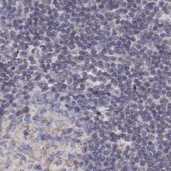 Invitrogen GSDMA Polyclonal Antibody 100 &mu;L; Unconjugated:Antibodies,