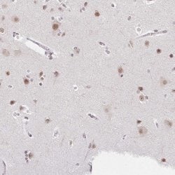 Invitrogen CA150 Polyclonal Antibody 100 &mu;L; Unconjugated:Antibodies,