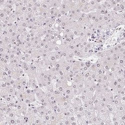 Invitrogen CA150 Polyclonal Antibody 100 &mu;L; Unconjugated:Antibodies,