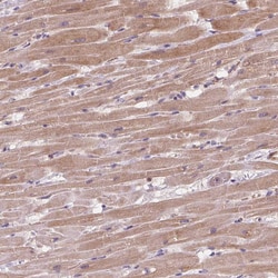 Invitrogen KCNK15 Polyclonal Antibody 100 &mu;L | Buy Online | Invitrogen&trade; | Fisher Scientific