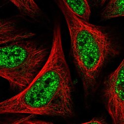 Invitrogen CARKL Polyclonal Antibody 100 &mu;L; Unconjugated:Antibodies,