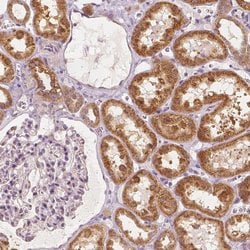 Invitrogen CARKL Polyclonal Antibody 100 &mu;L; Unconjugated:Antibodies,