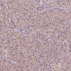 Invitrogen CARKL Polyclonal Antibody 100 &mu;L; Unconjugated:Antibodies,