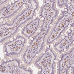 Invitrogen BATF Polyclonal Antibody 100 &mu;L; Unconjugated:Antibodies,