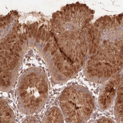 Invitrogen STARD7 Polyclonal Antibody 100 &mu;L; Unconjugated:Antibodies,