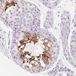 Invitrogen Aquaporin 5 Polyclonal Antibody 100 &mu;L; Unconjugated:Antibodies,