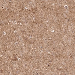 Invitrogen RIC3 Polyclonal Antibody 100 &mu;L | Buy Online | Invitrogen&trade; | Fisher Scientific