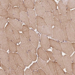 Invitrogen RIC3 Polyclonal Antibody 100 &mu;L | Buy Online | Invitrogen&trade; | Fisher Scientific