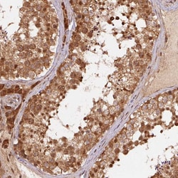 Invitrogen TREML4 Polyclonal Antibody 100 &mu;L; Unconjugated:Antibodies,