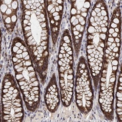 Invitrogen GADD45GIP1 Polyclonal Antibody 100 &mu;L; Unconjugated:Antibodies,
