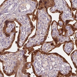 Invitrogen HSD17B1 Polyclonal Antibody 100 &mu;L; Unconjugated:Antibodies,