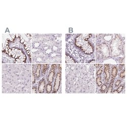 Invitrogen GALNT7 Polyclonal Antibody 100 &mu;L; Unconjugated:Antibodies,