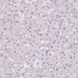 Invitrogen GALNT7 Polyclonal Antibody 100 &mu;L; Unconjugated:Antibodies,