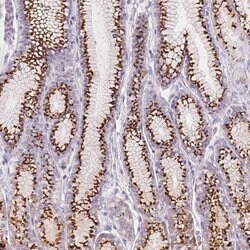 Invitrogen GALNT7 Polyclonal Antibody 100 &mu;L; Unconjugated:Antibodies,