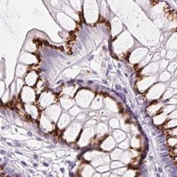 Invitrogen GALNT7 Polyclonal Antibody 100 &mu;L; Unconjugated:Antibodies,