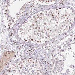 Invitrogen SMIM12 Polyclonal Antibody 100 &mu;L; Unconjugated:Antibodies,