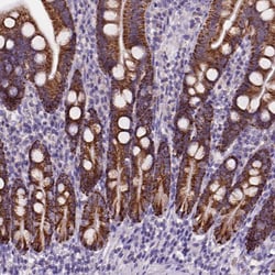 Invitrogen L2HGDH Polyclonal Antibody 100 &mu;L; Unconjugated:Antibodies,