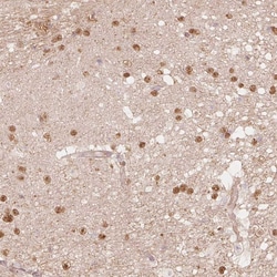 Invitrogen QDPR Polyclonal Antibody 100 &mu;L; Unconjugated:Antibodies,