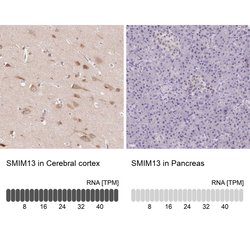 Invitrogen SMIM13 Polyclonal Antibody 100 &mu;L; Unconjugated:Antibodies,