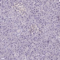 Invitrogen SMIM13 Polyclonal Antibody 100 &mu;L; Unconjugated:Antibodies,