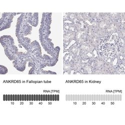 Invitrogen ANKRD65 Polyclonal Antibody 100 &mu;L; Unconjugated:Antibodies,