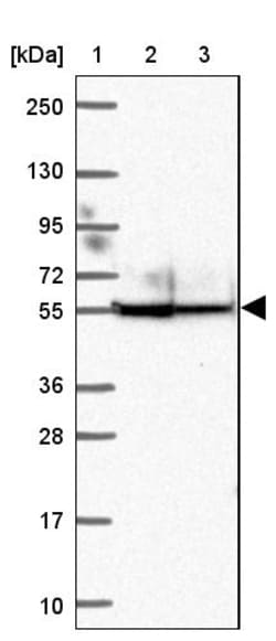 Invitrogen ANKRD65 Polyclonal Antibody 100 &mu;L; Unconjugated:Antibodies,