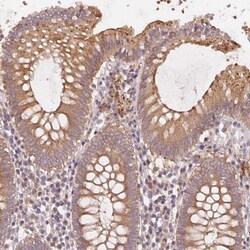 Invitrogen KLHL15 Polyclonal Antibody 100 &mu;L; Unconjugated:Antibodies,