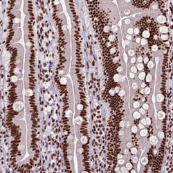 Invitrogen NSE2 Polyclonal Antibody 100 &mu;L; Unconjugated:Antibodies,