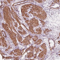 Invitrogen MIER3 Polyclonal Antibody 100 &mu;L; Unconjugated:Antibodies,