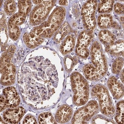 Invitrogen RNF123 Polyclonal Antibody 100 &mu;L; Unconjugated:Antibodies,
