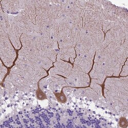 Invitrogen alpha-2b Adrenergic Receptor Polyclonal Antibody 100 &mu;L;