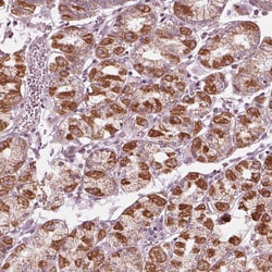 Invitrogen CLN6 Polyclonal Antibody 100 &mu;L; Unconjugated:Antibodies,