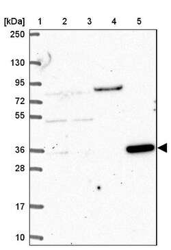 Invitrogen CLN6 Polyclonal Antibody 100 &mu;L; Unconjugated:Antibodies,