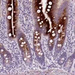 Invitrogen NUDT6 Polyclonal Antibody 100 &mu;L; Unconjugated:Antibodies,