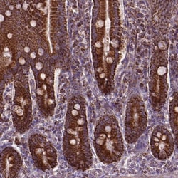 Invitrogen PIBF1 Polyclonal Antibody 100 &mu;L; Unconjugated:Antibodies,