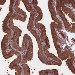 Invitrogen eIF3d Polyclonal Antibody 100 &mu;L; Unconjugated:Antibodies,