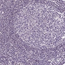Invitrogen GLUT9 Polyclonal Antibody 100 &mu;L; Unconjugated:Antibodies,