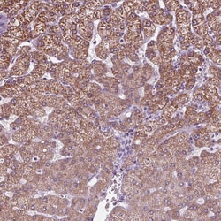 Invitrogen CYP3A43 Polyclonal Antibody 100 &mu;L | Buy Online | Invitrogen&trade; | Fisher Scientific