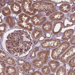 Invitrogen MZT1 Polyclonal Antibody 100 &mu;L; Unconjugated:Antibodies,