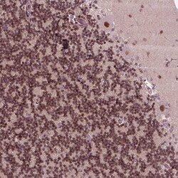 Invitrogen LSM2 Polyclonal Antibody 100 &mu;L; Unconjugated:Antibodies,