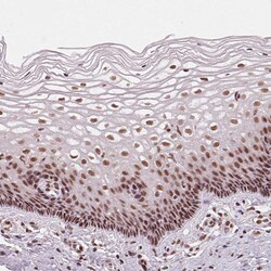 Invitrogen LSM2 Polyclonal Antibody 100 &mu;L; Unconjugated:Antibodies,