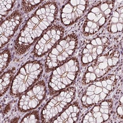 Invitrogen LSM2 Polyclonal Antibody 100 &mu;L; Unconjugated:Antibodies,