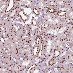 Invitrogen LSM2 Polyclonal Antibody 100 &mu;L; Unconjugated:Antibodies,